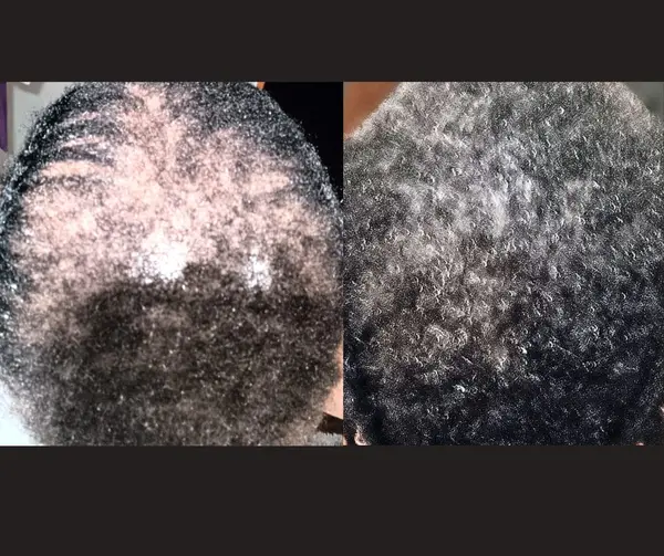 Finale Growth Serum - Image 2